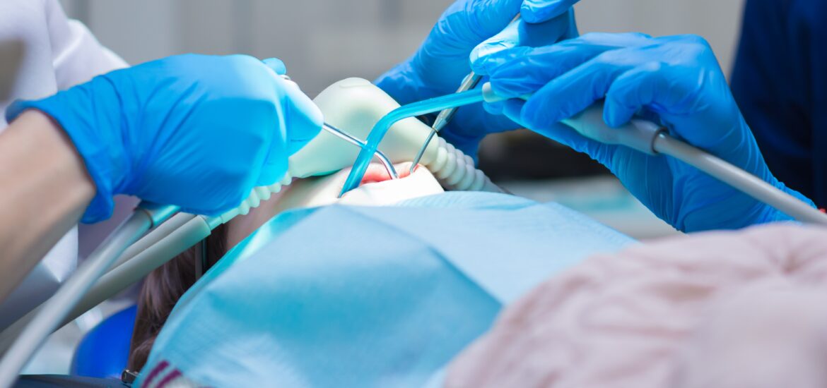 dentist in blue gloves using sedation during a dental procedure